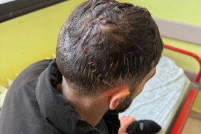 Edirne’de iş kazasında hafızasını kaybetti: Sadece annesini hatırlıyor