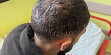 Edirne’de iş kazasında hafızasını kaybetti: Sadece annesini hatırlıyor