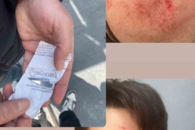 Milli sporcuya eski antrenörü saldırdı; vücudunda çok sayıda kesik oluştu