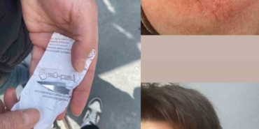 Milli sporcuya eski antrenörü saldırdı; vücudunda çok sayıda kesik oluştu