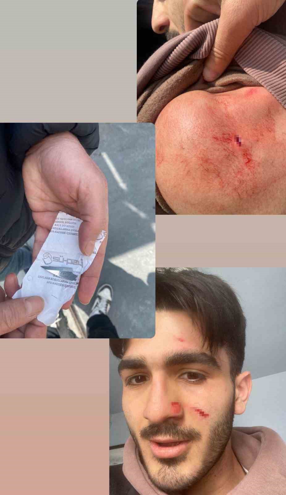 Milli sporcuya eski antrenörü saldırdı; vücudunda çok sayıda kesik oluştu