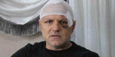 Öldüresiye darp edilen tekel bayii işletmecisi yaşadığı dehşeti anlattı