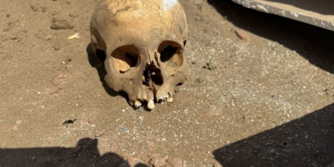 İnşaat işçilerinin bulduğu kafatası ekipleri harekete geçirdi