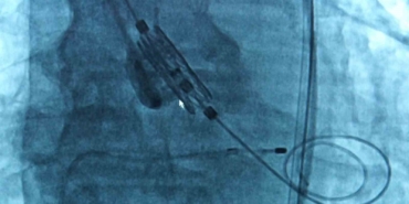 Uzmanlar uyarıyor: "Nefes darlığı, yorulmayı yaşlılığa bağlamayın, kalp hastalığının habercisi olabilir"