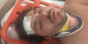 Darp edilen oyuncu dehşet anlarını anlattı: "Ölecektim"