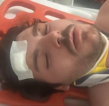 Darp edilen oyuncu dehşet anlarını anlattı: "Ölecektim"