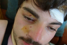 Trafikte darbedilen oyuncu Mehmet Akif Akdeniz yaşadığı dehşeti anlattı