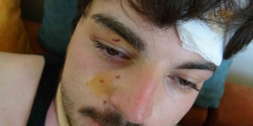 Trafikte darbedilen oyuncu Mehmet Akif Akdeniz yaşadığı dehşeti anlattı