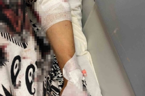 Abdest almak için bahçeye çıkan kadına köpekler saldırdı