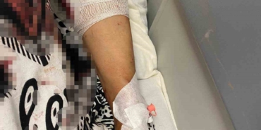 Abdest almak için bahçeye çıkan kadına köpekler saldırdı