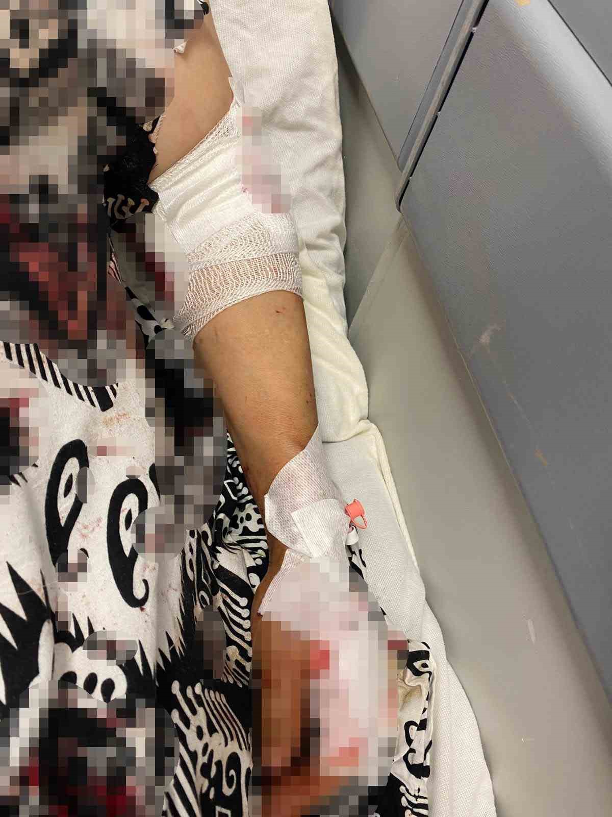 Abdest almak için bahçeye çıkan kadına köpekler saldırdı