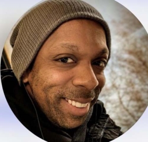 Saç ekiminin ardından fenalaşan İngiliz hasta hayatını kaybetti