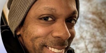 Saç ekiminin ardından fenalaşan İngiliz hasta hayatını kaybetti