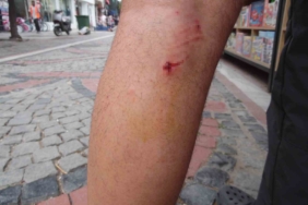 Başıboş 8 köpek, köpeğini gezdiren vatandaşa saldırdı