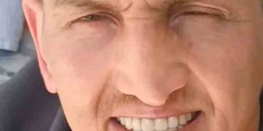 İstanbul’da burun estetiği ameliyatının ardından hayatını kaybetti