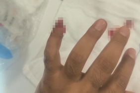 Uyuşturucuyla yakalanan şüpheli, polisin parmağını kopardı