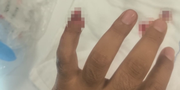 Uyuşturucuyla yakalanan şüpheli, polisin parmağını kopardı