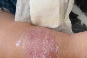 Büyükçekmece’de sigara dumanı tartışmasında kolunu ısırdı