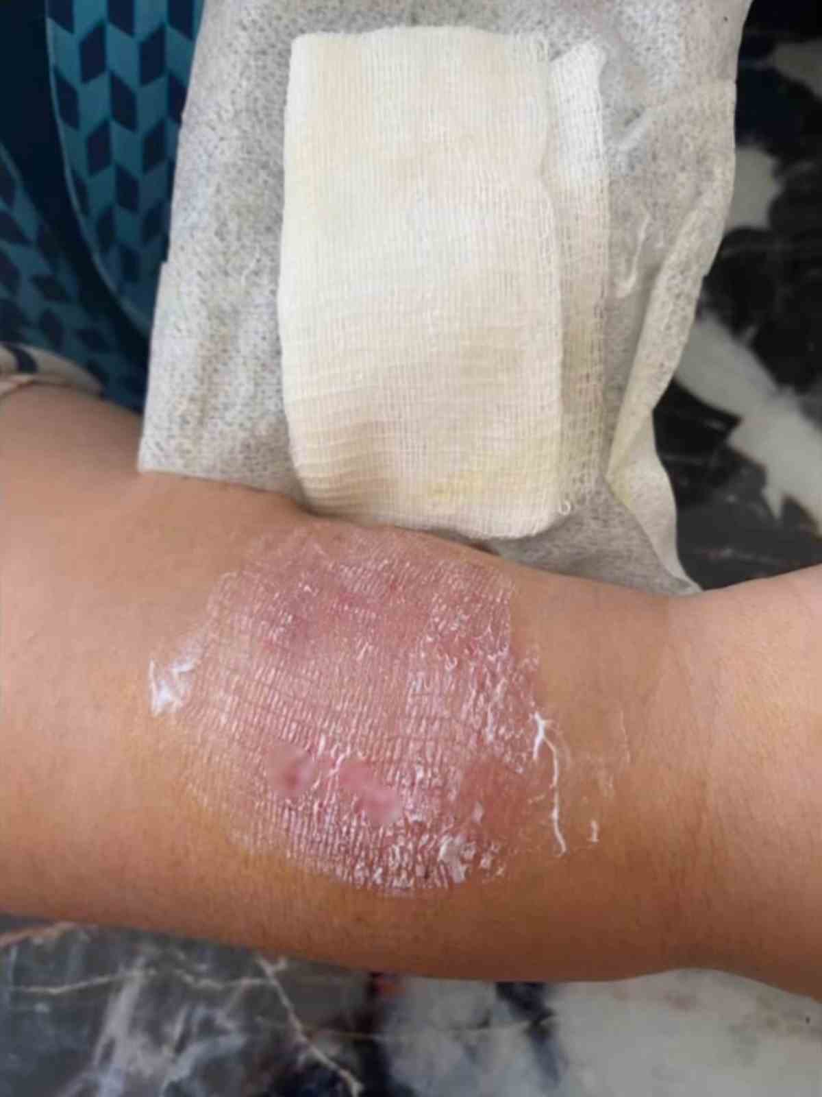 Büyükçekmece’de sigara dumanı tartışmasında kolunu ısırdı