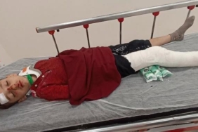 Başakşehir’de 8 yaşındaki çocuğa trafiğe kapalı alanda motosiklet çarptı: Baba yardım istedi