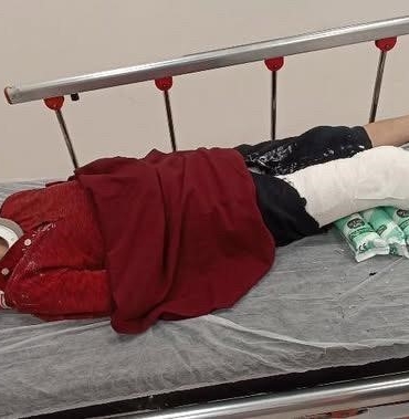 Başakşehir’de 8 yaşındaki çocuğa trafiğe kapalı alanda motosiklet çarptı: Baba yardım istedi