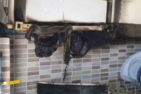 Bilecik’te aspiratör alev alırken, bir kişi yaralandı