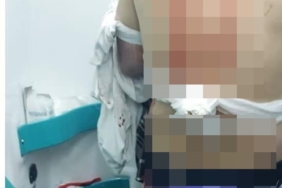 Abisini sokak ortasında silahla vurarak öldürdü