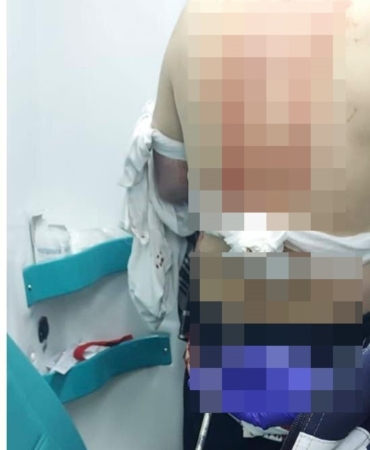 Abisini sokak ortasında silahla vurarak öldürdü
