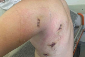 Kız kardeşini korumak isterken 5 yerinden bıçaklanmıştı: O anları anlattı: "Ölümden döndüm"