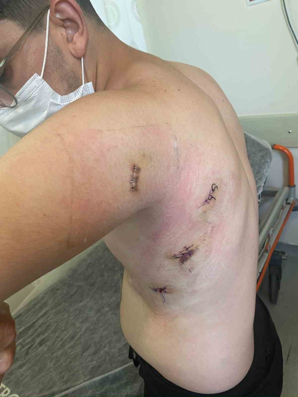 Kız kardeşini korumak isterken 5 yerinden bıçaklanmıştı: O anları anlattı: "Ölümden döndüm"