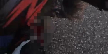 Motosikletiyle bariyere çarpmıştı, hayata 25 gün tutunabildi