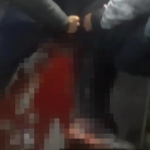 Üsküdar’da bıçaklı kavga : 1 yaralı