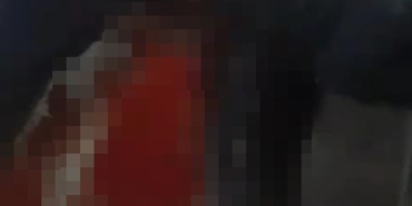 Üsküdar’da bıçaklı kavga : 1 yaralı