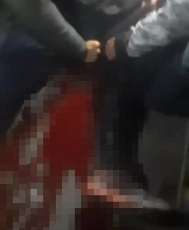 Üsküdar’da bıçaklı kavga : 1 yaralı