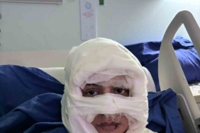 Kadıköy’de akıl almaz olay: Genç kadın başka bir kadın tarafından ateşe verildi