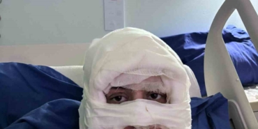 Kadıköy’de akıl almaz olay: Genç kadın başka bir kadın tarafından ateşe verildi