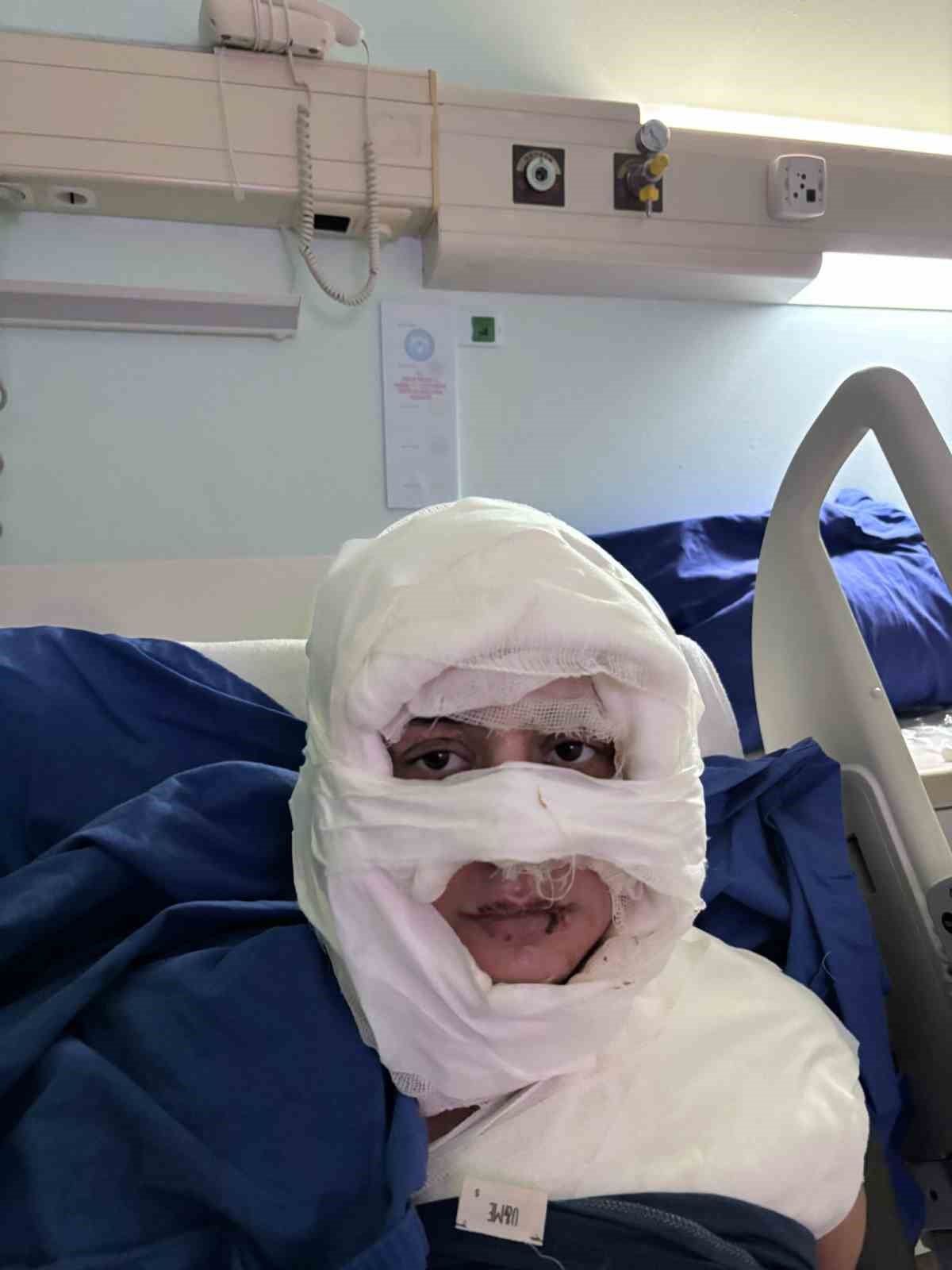 Kadıköy’de akıl almaz olay: Genç kadın başka bir kadın tarafından ateşe verildi