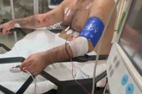 Bayrampaşa’da pompalı tüfekle çevreye ateş eden şahıs, 1’i polis 4 kişiyi yaraladı