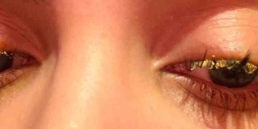 Güzellik merkezinde genç kadının gözüne yapıştırıcı kaçtı: "Kör olabilirdim"