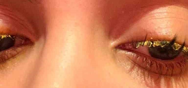 Güzellik merkezinde genç kadının gözüne yapıştırıcı kaçtı: "Kör olabilirdim"