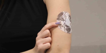 Diyabet tedavisinde yapay zeka destekli teknolojilerle "Yapay Pankreas" dönemi başlıyor