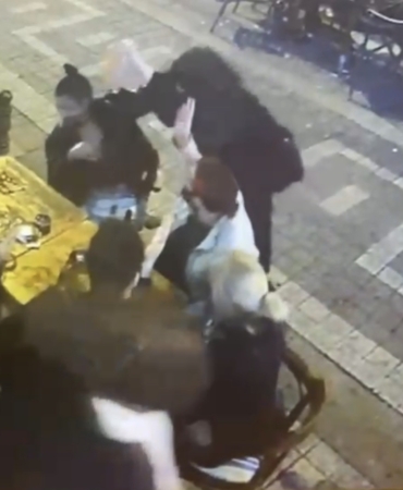 Kadıköy’de dehşet anlarının görüntüsü ortaya çıktı... Genç kadının yüzünü böyle yaktı