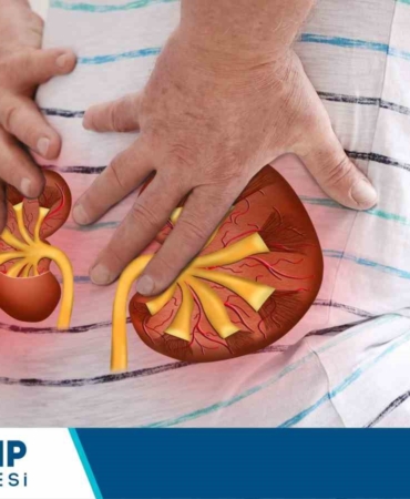 Böbrek taşı vakalarında kişiye özel tedavi