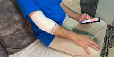 Başakşehir’de sitenin güvenlik görevlisine sahipli köpek saldırdı