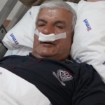 65 yaşındaki adamın burnundan 100 gramlık taş çıkarıldı