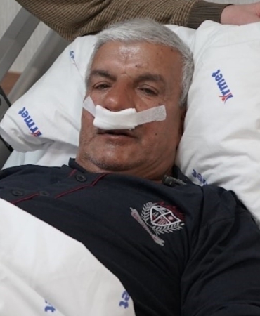 65 yaşındaki adamın burnundan 100 gramlık taş çıkarıldı