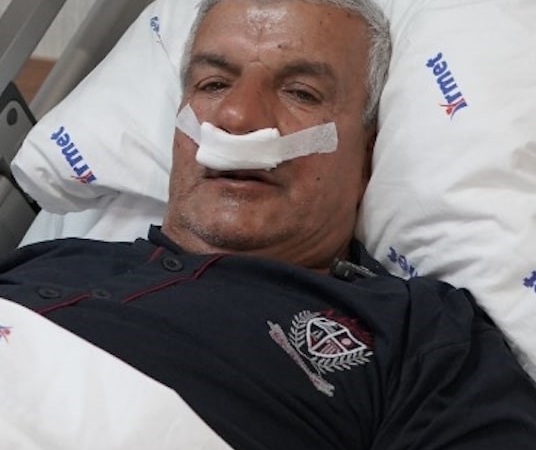 65 yaşındaki adamın burnundan 100 gramlık taş çıkarıldı