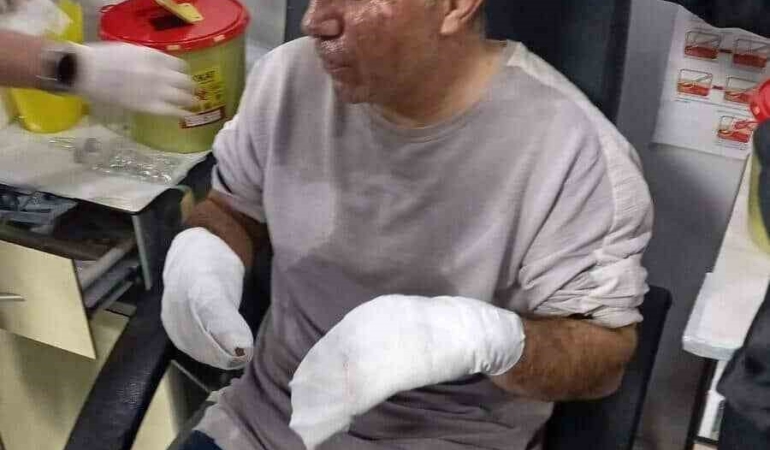 Avcılar’da seyir halinde yanan minibüsün alevler içinde kaldığı görüntüler ortaya çıktı