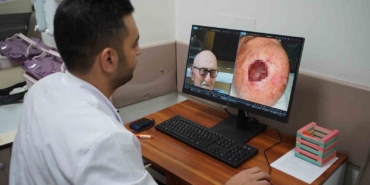 Dünyada 3’üncü kez rastlandı: Saçlı derideki nadir tümör Sakarya’da tedavi edildi