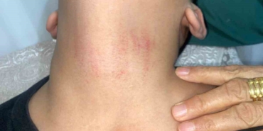 Küçükçekmece’de kadın memurun 10 yaşındaki öğrenciyi okulda darbettiği iddiası